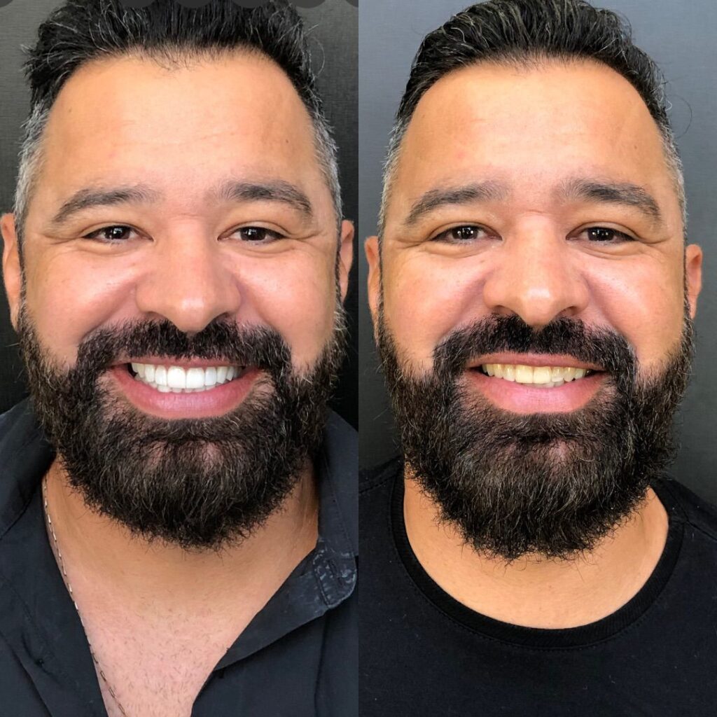 Marcelo